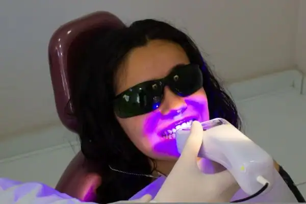 the science behind laser teeth whitening Gosport